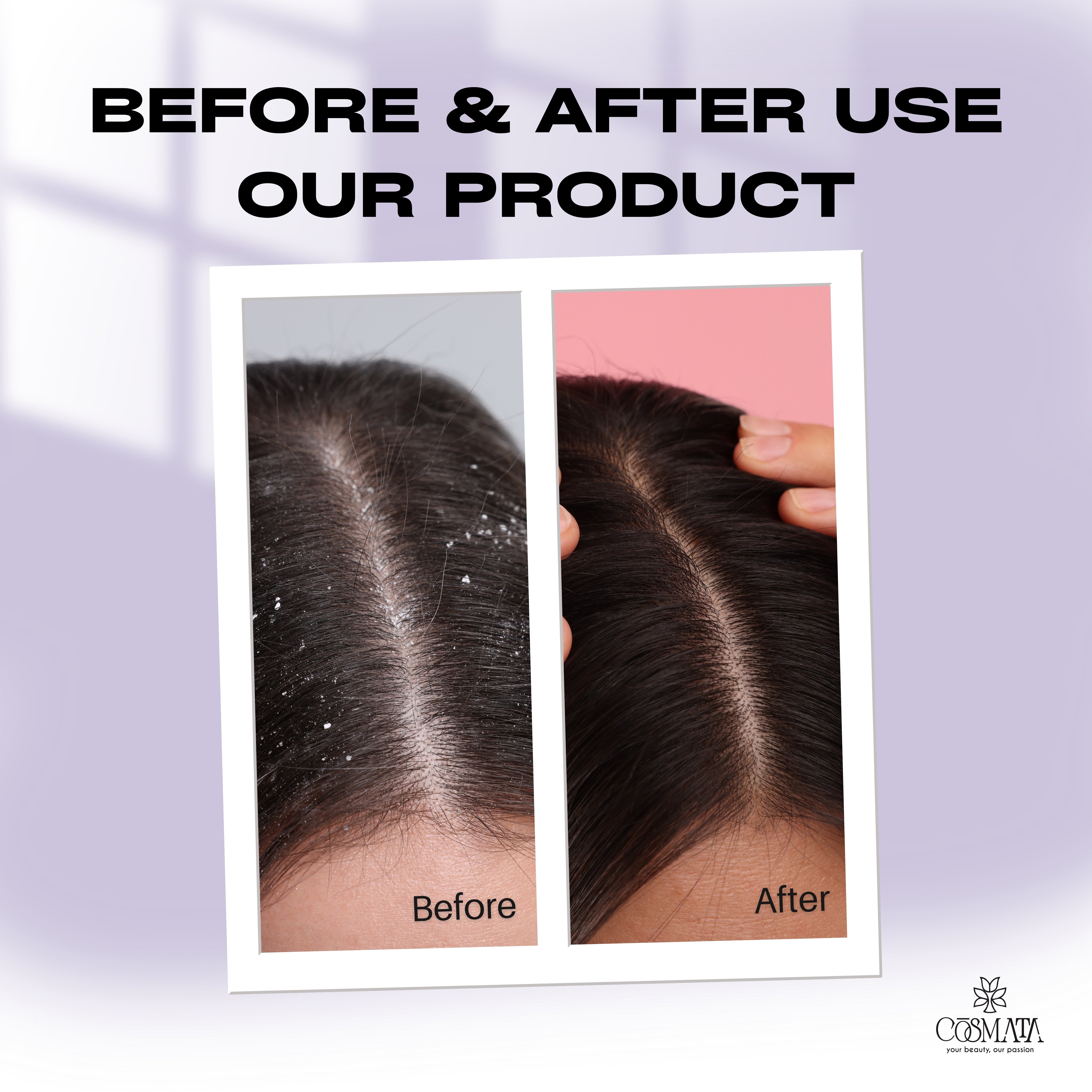 Cosmata Anti-Dandruff Shampoo 200ml – Flake-Free, Itch Relief & Scalp Care